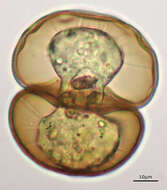 Image of Arcella hemisphaerica