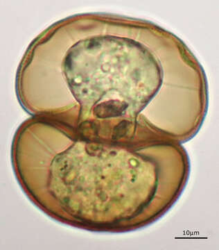 Image of Arcella hemisphaerica