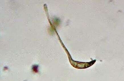 Image of Lacrymaria olor