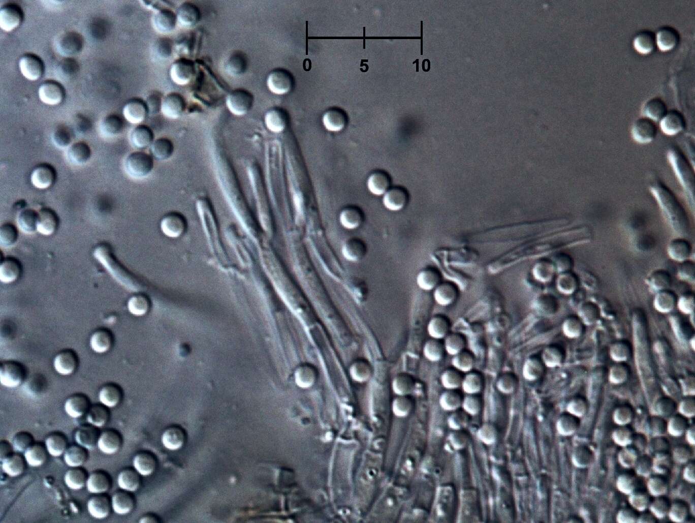 Image of Orbilia crocina (Mont. & Fr.) Sacc. 1889