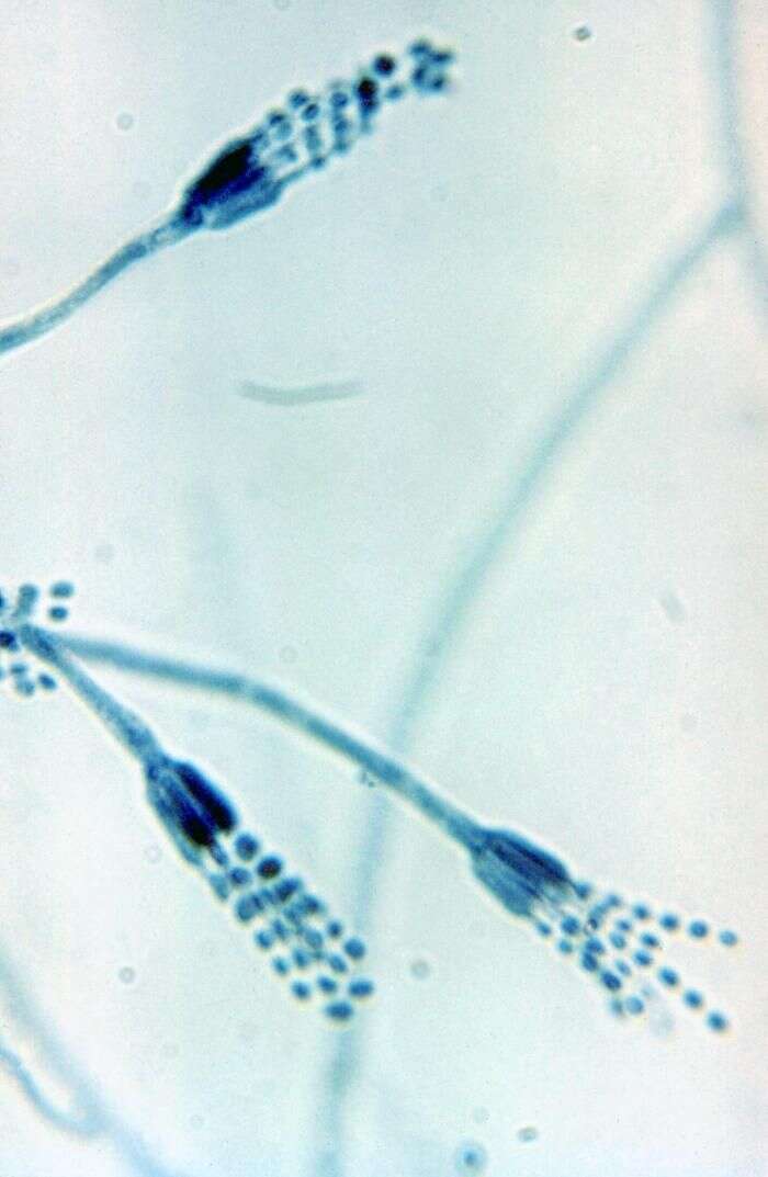 Image of Penicillium