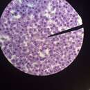 Imagem de Plasmodium falciparum