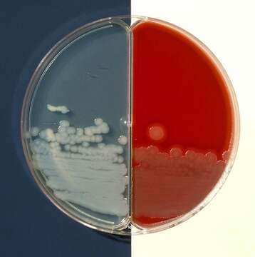 Bacillus cereus resmi