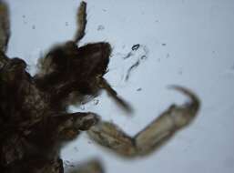 Image of Body Louse