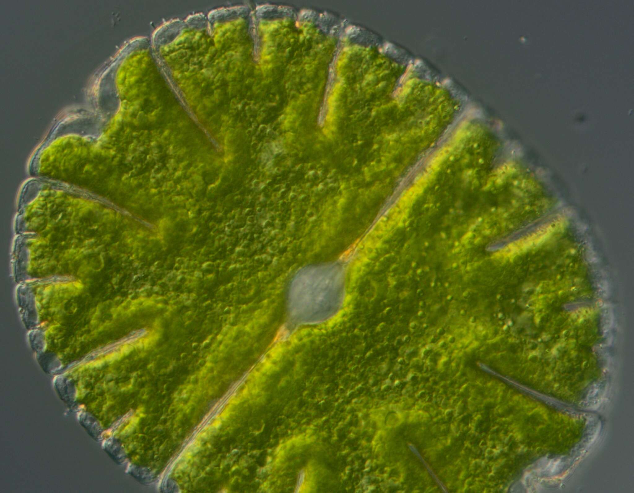 Image of Micrasterias denticulata