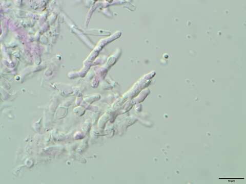 Biatoropsis usnearum Räsänen 1934的圖片