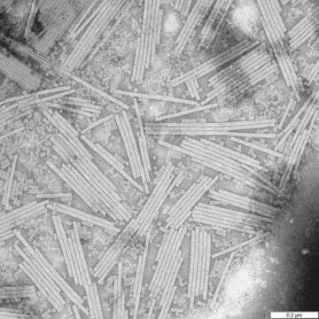 Image of Tobacco mosaic virus