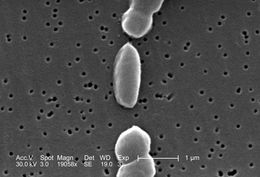 Image of <i>Vibrio parahaemolyticus</i>