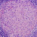 Image of Mycobacterium avium