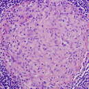 Image de Mycobacterium avium