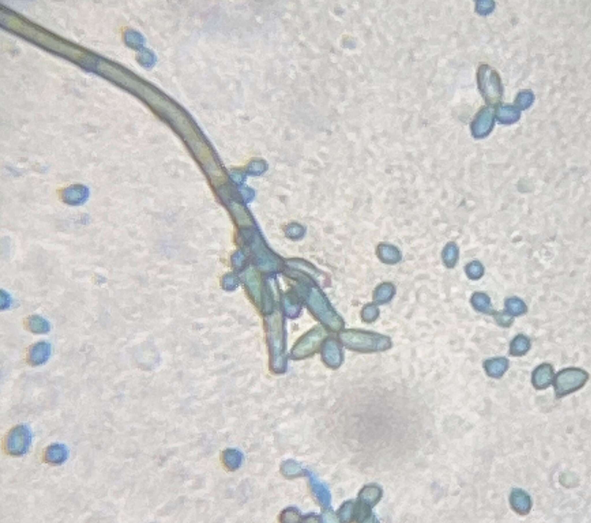Image of Cladosporium perangustum Bensch, Crous & U. Braun 2010