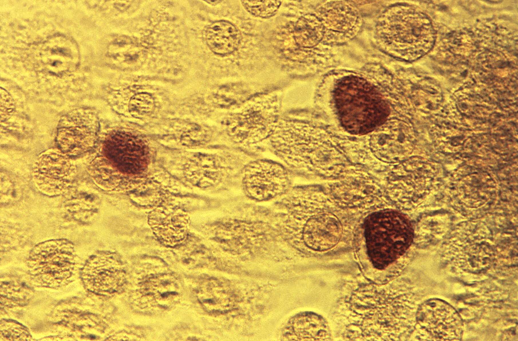 Image of Chlamydia trachomatis