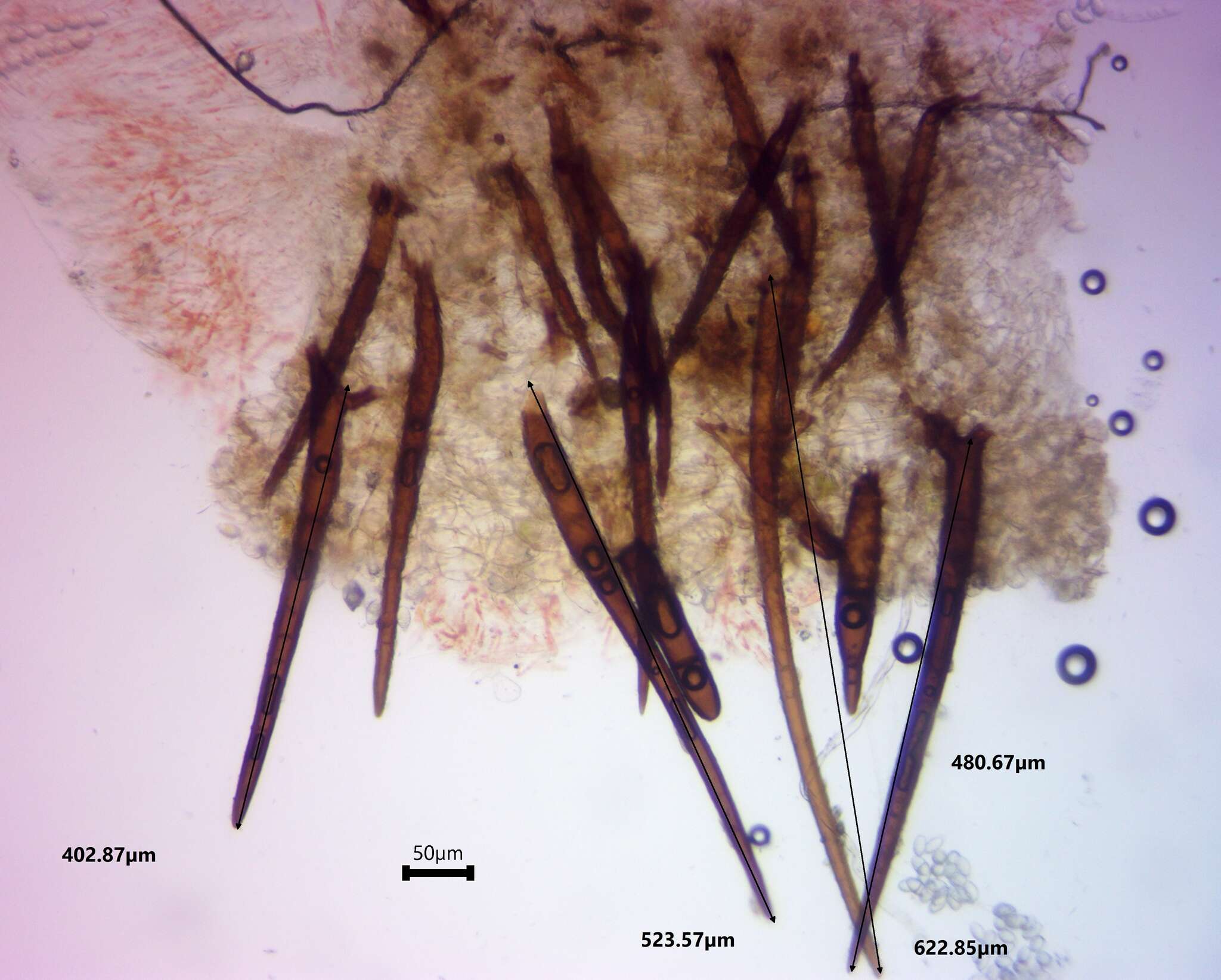 Image de Scutellinia vitreola Kullman 1982