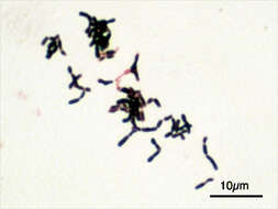 Image of Bifidobacterium