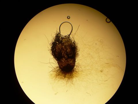 Image of Chaetomium