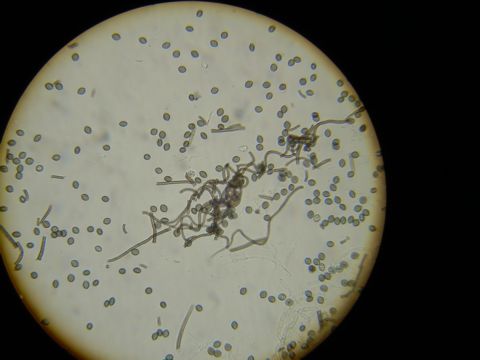 Image of Chaetomium