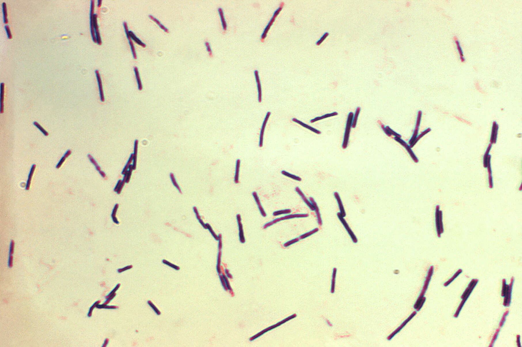 Image de Clostridium perfringens