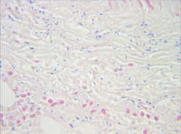 Слика од Clostridium perfringens