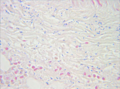 Imagem de Clostridium perfringens