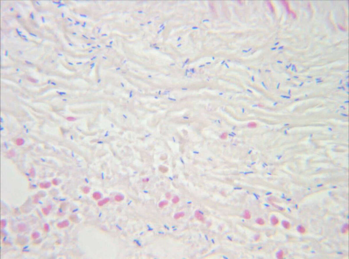 Image of Clostridium perfringens