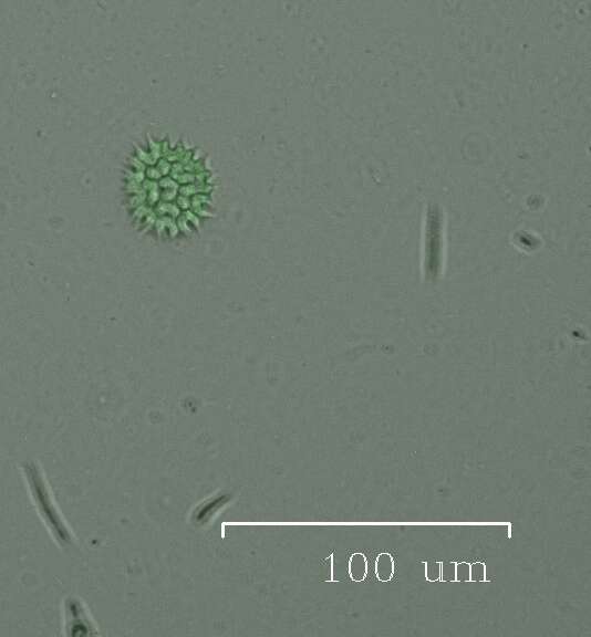 صورة Pseudopediastrum