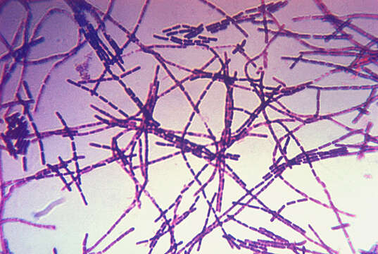 Imagem de Bacillus anthracis