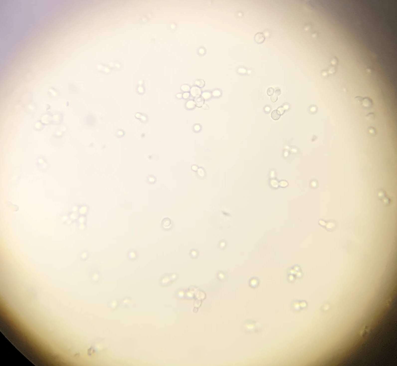 Image of Saccharomyces