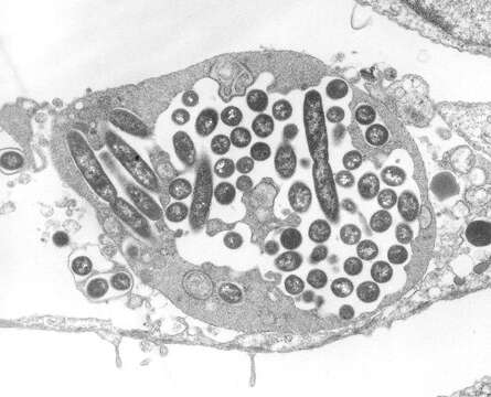 Image of Legionella pneumophila