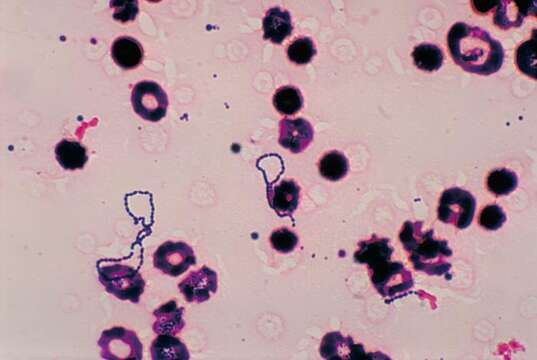 Plancia ëd Streptococcus viridans