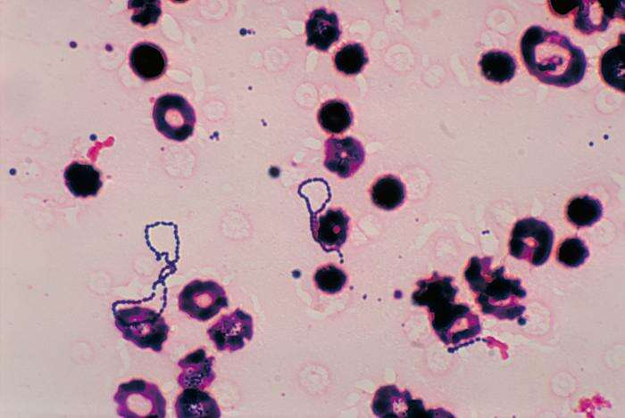 Image of Streptococcus viridans