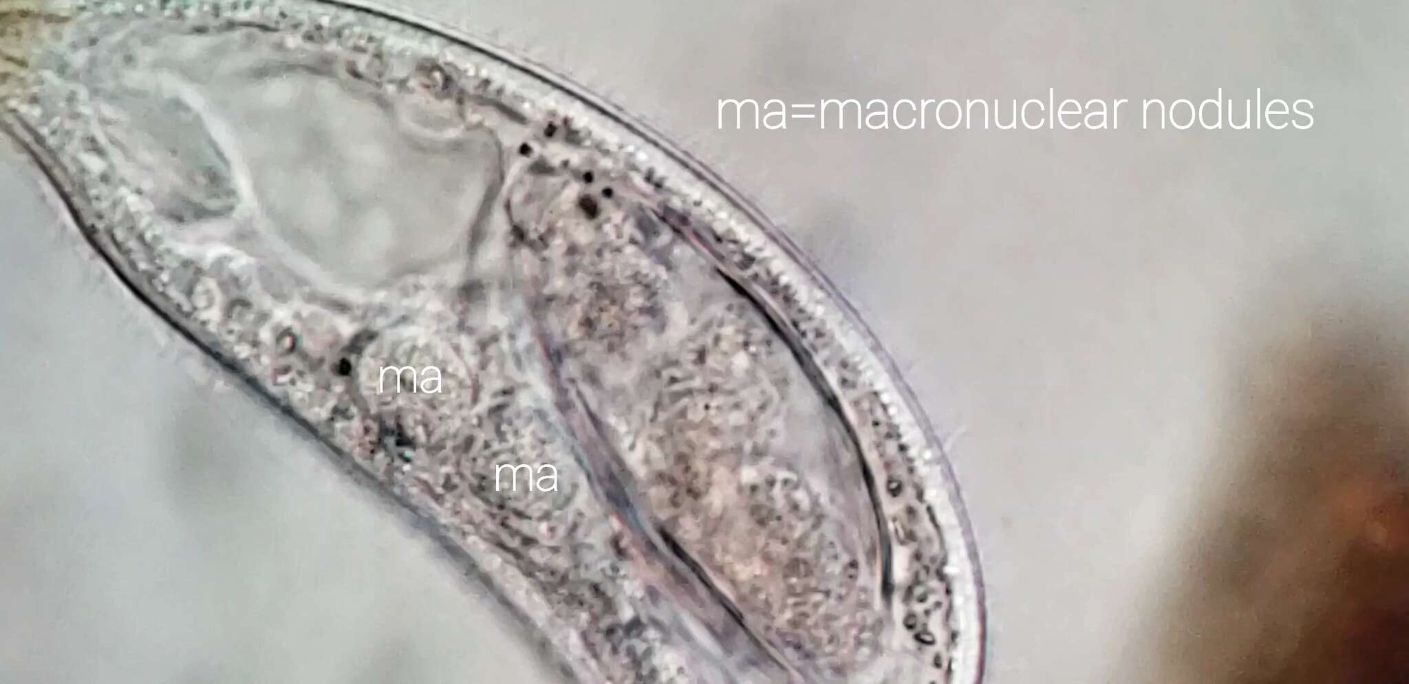 Tracheliidae resmi