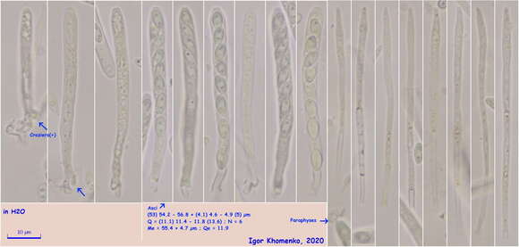 Image of Lachnellula agassizii (Berk. & M. A. Curtis) Dennis 1962