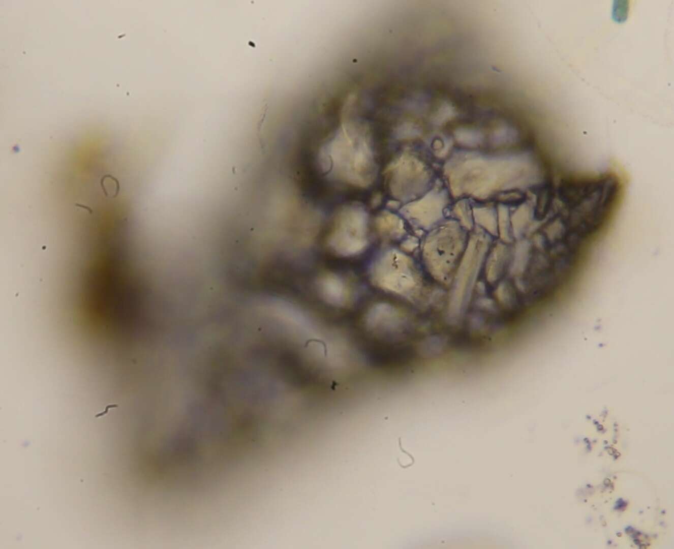 Image of Difflugia nodosa