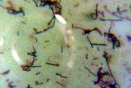 Imagem de Clostridium tetani