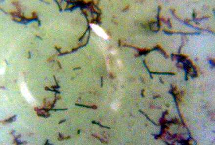 Image of Clostridium tetani