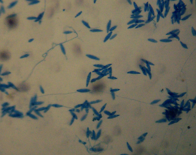 Image of <i>Microsporum gypseum</i> (E. Bodin) Guiart & Grigoraki 1928