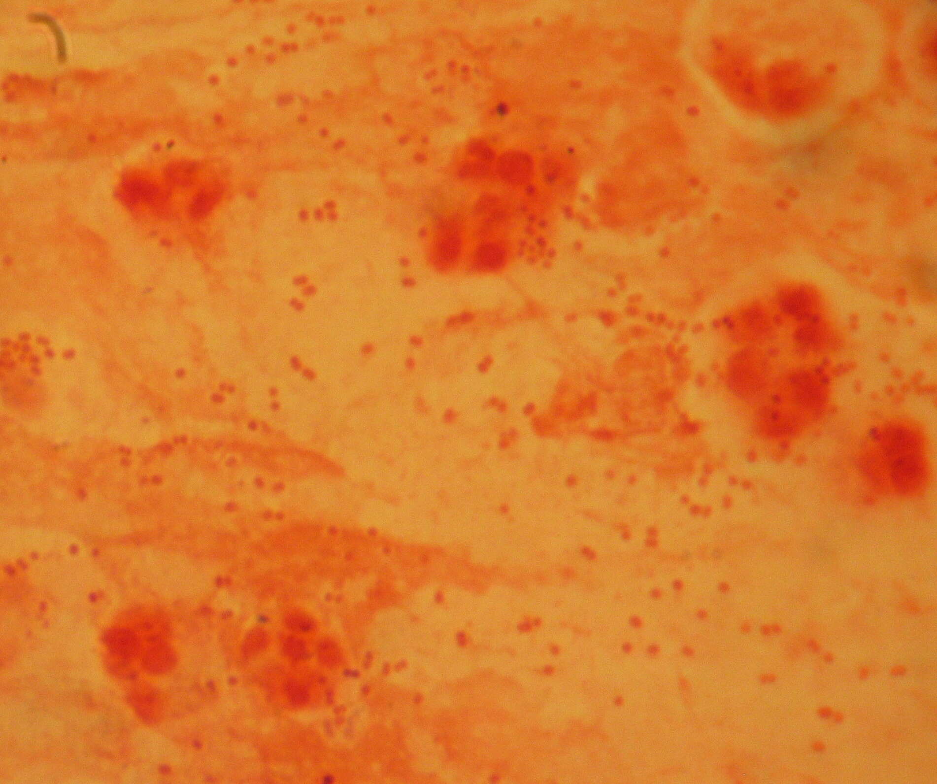 Image of Haemophilus influenzae