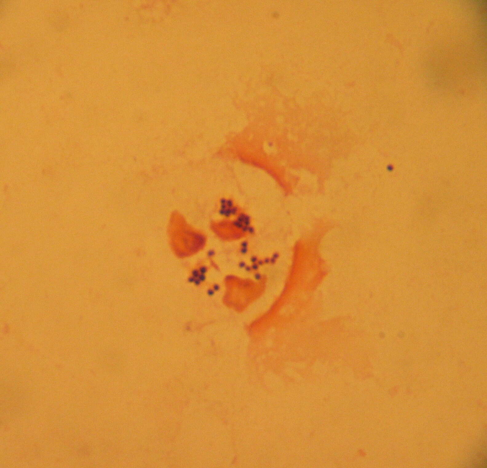 Image of Staphylococcaceae