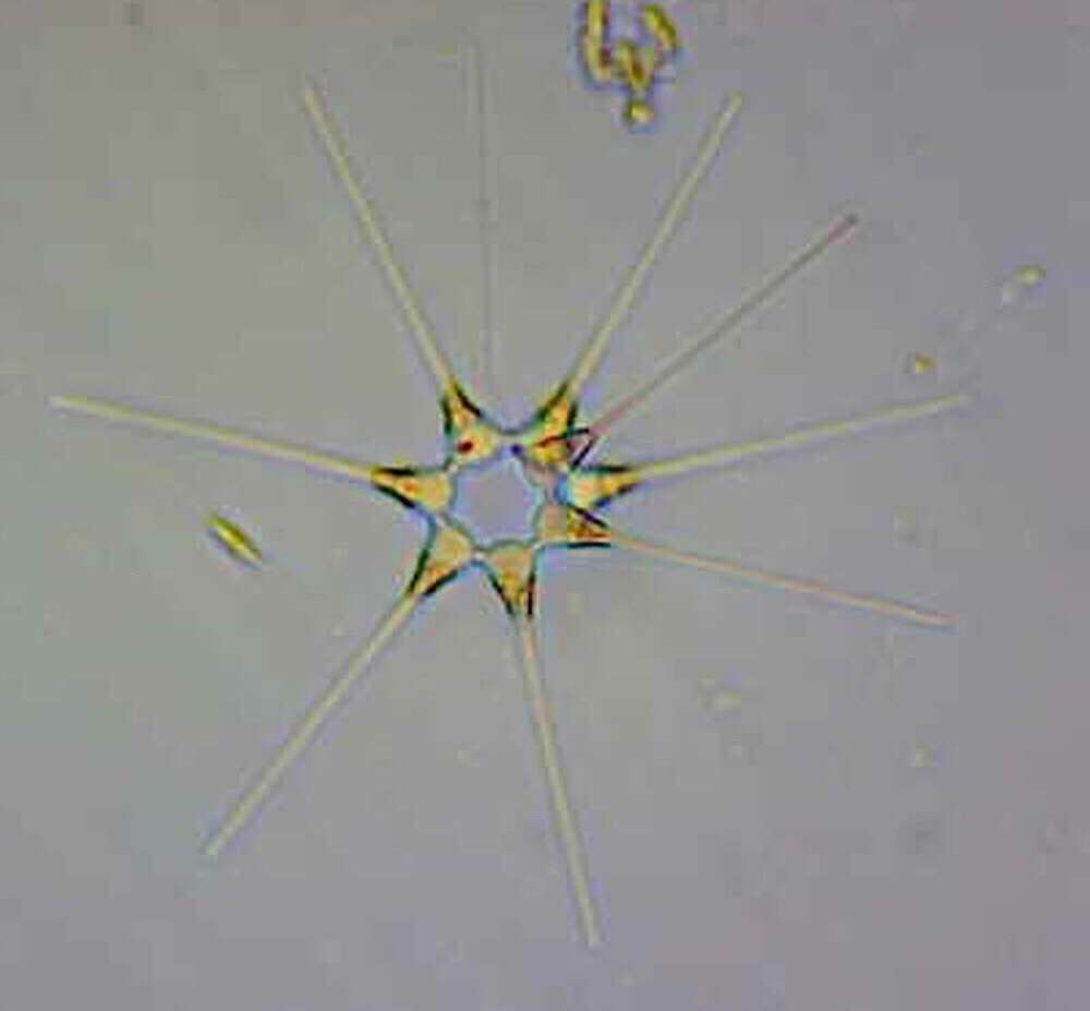 Sivun Asterionellopsis kuva