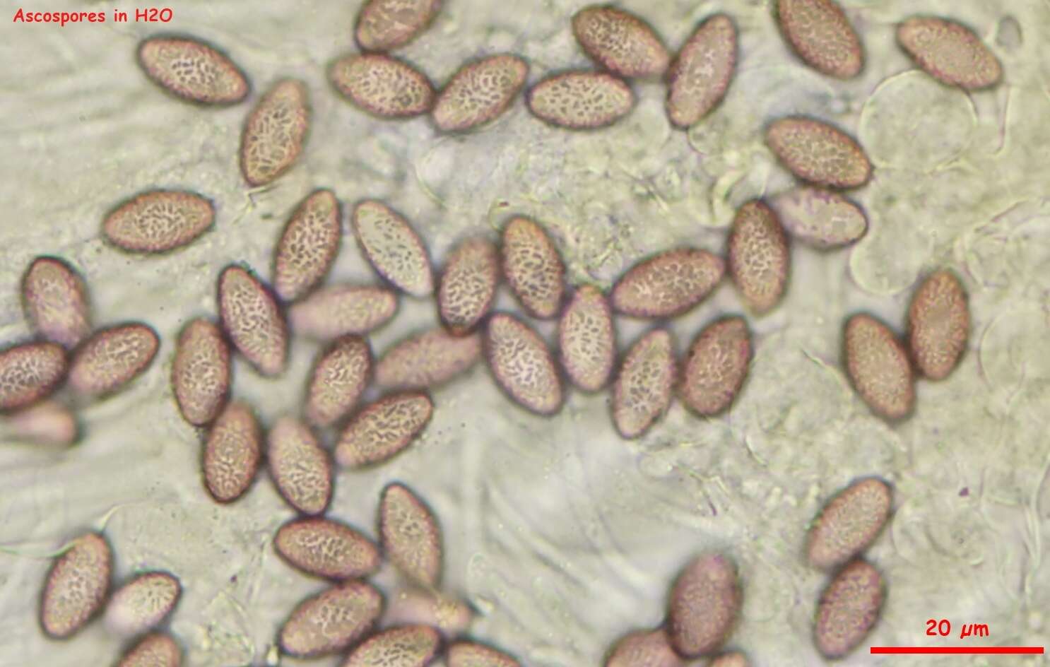 Image de Ascobolus lineolatus Brumm. 1967