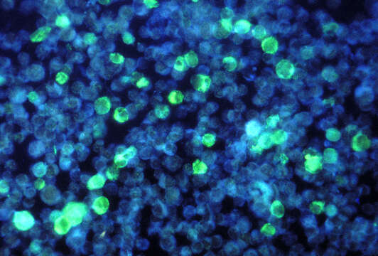 Image de Human herpesvirus 4