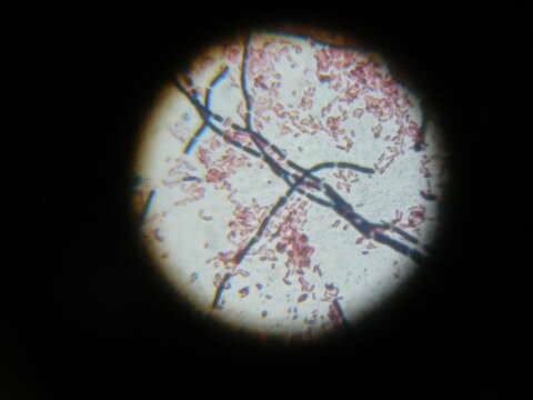 Image of Bacillus cereus