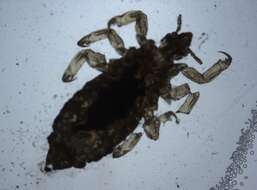 Image of Body Louse