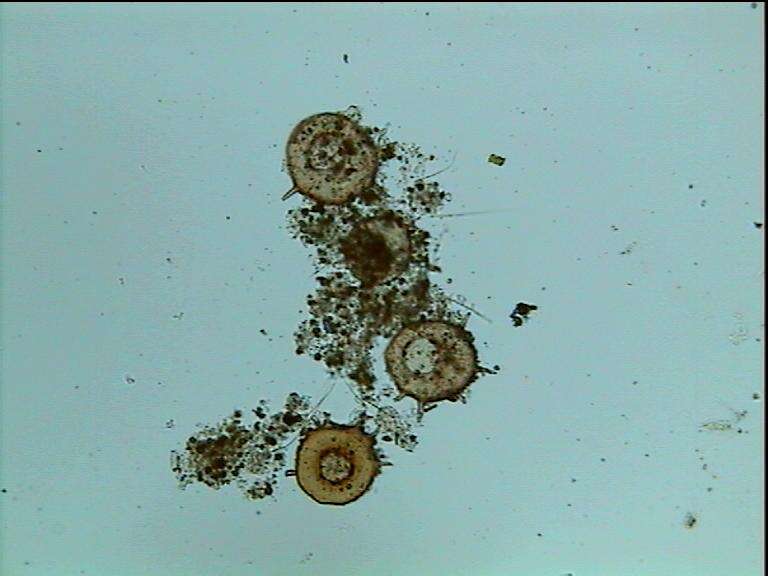 Image of testate lobose amoebae