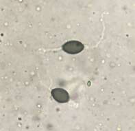 Image of Podospora araneosa (Cain) Cain 1962