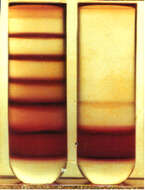 Image of Plasmodium subgen. Laverania