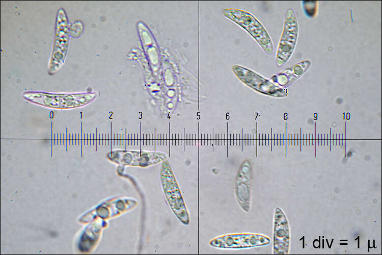 Image of Ascocoryne sarcoides (Jacq.) J. W. Groves & D. E. Wilson 1967