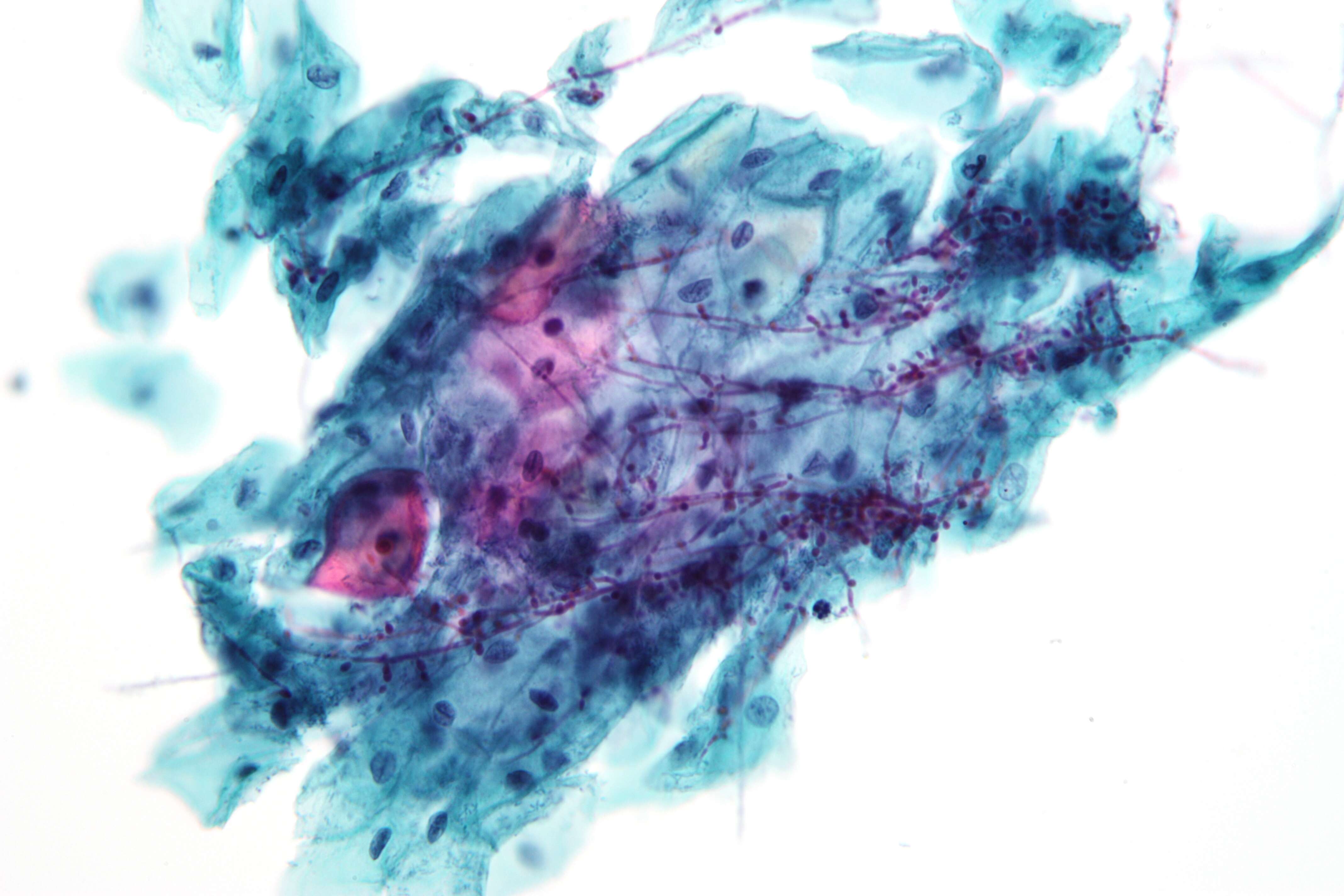 Image of unclassified Saccharomycetales