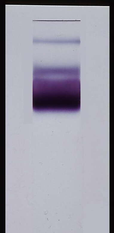 Image of Plasmodium subgen. Laverania