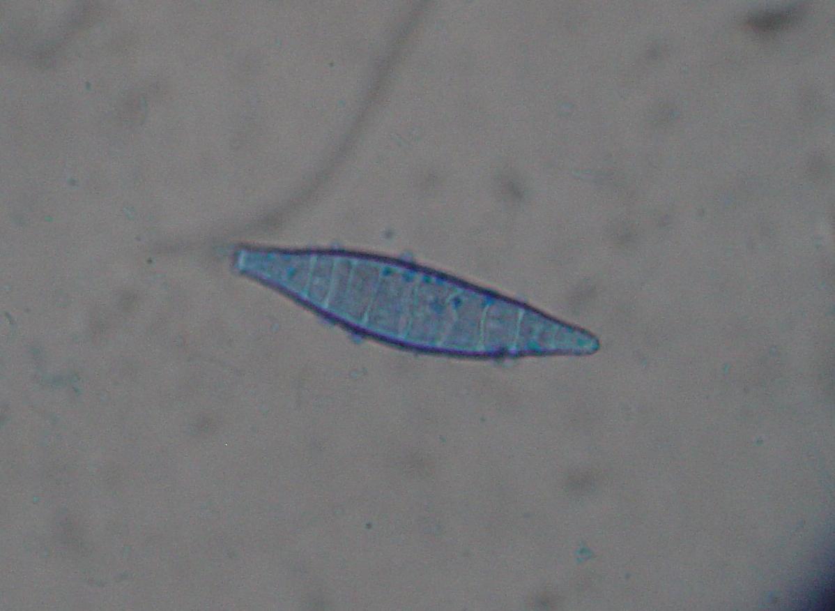 Image of <i>Microsporum canis</i> E. Bodin ex Guég. 1902